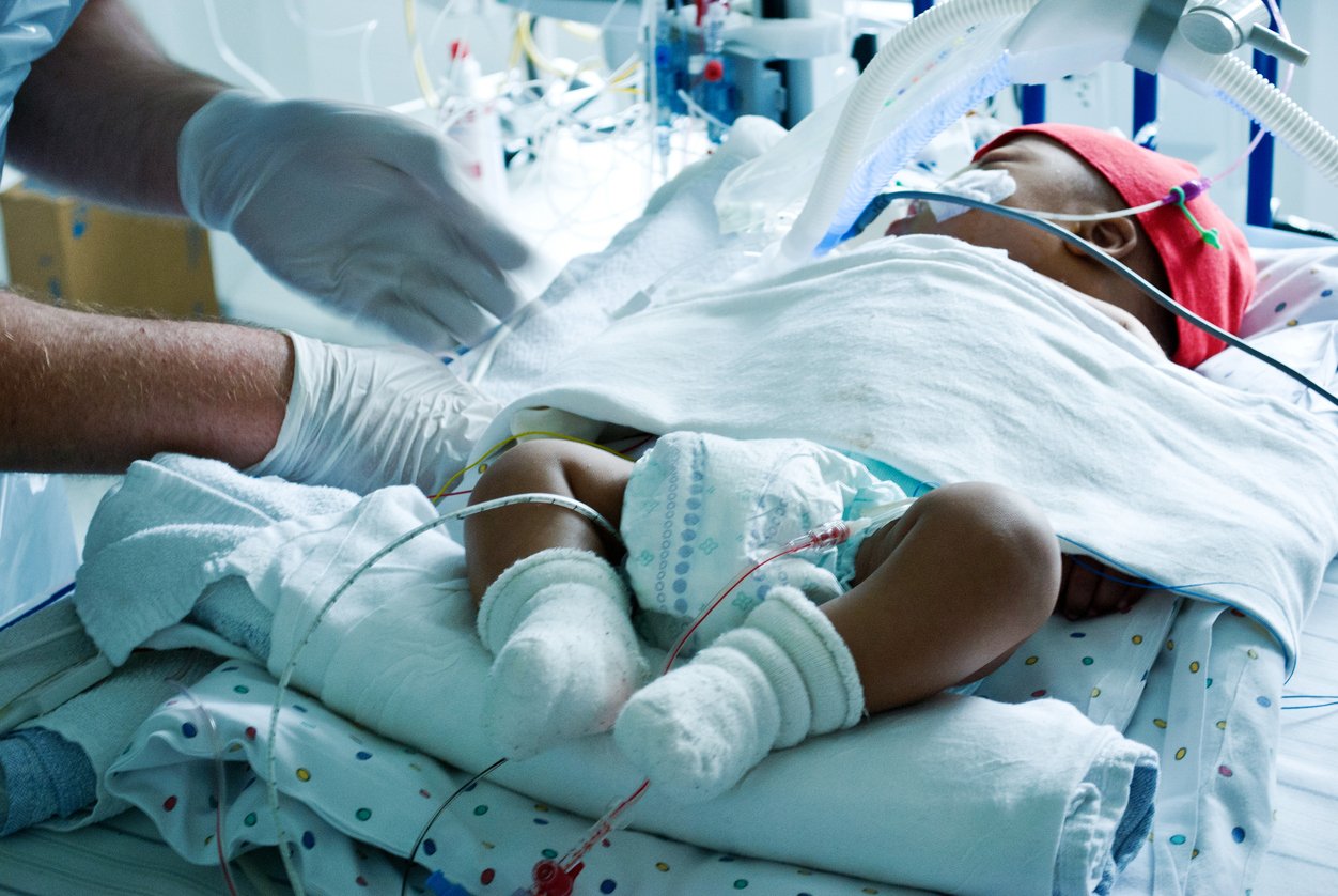 a baby in the nicu unit